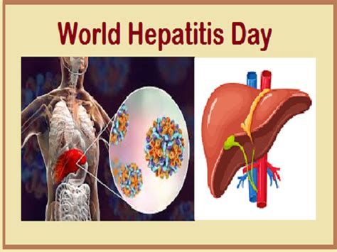 World Hepatitis Day 2020: Current Theme, History ...