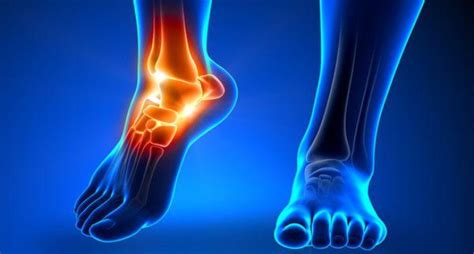 Easier Recovery From Ankle Fracture Trauma Blog Axis Orthopedic