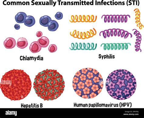 Common Sexually Transmitted Infections Sti Illustration Stock Vector