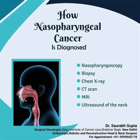 Nasopharyngeal Cancer Symptoms Stages Treatment