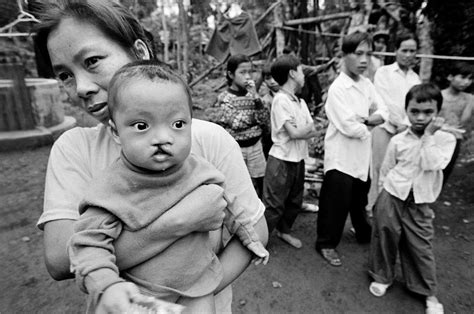 Agent Orange Collateral Damage In Vietnam • Philip Jones Griffiths • Magnum Photos