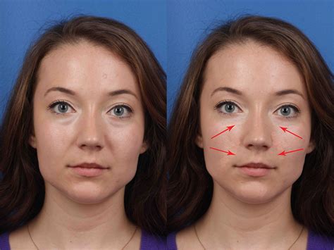 Before And After Plastic Surgery Images Srz Php