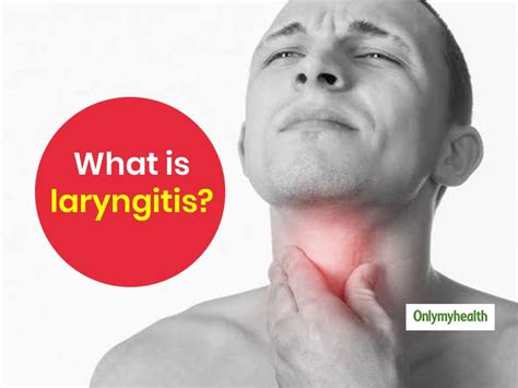 What Is Laryngitis Know The Symptoms Causes And Treatment From An