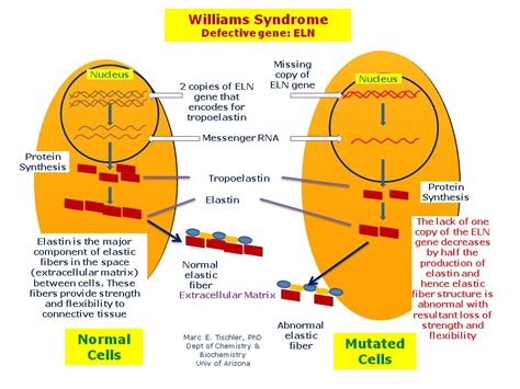 Williams Syndrome Hereditary Ocular Diseases
