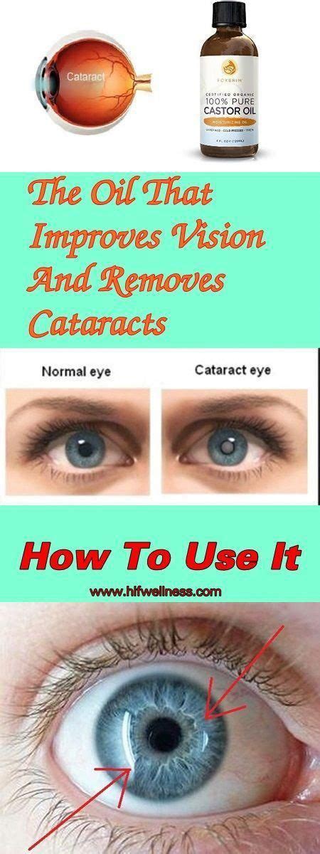 The Oil That Improves Vision And Removes Cataracts How To Use It