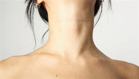 Trending Health 1135io How To Reduce Swelling In Neck Due To Thyroid