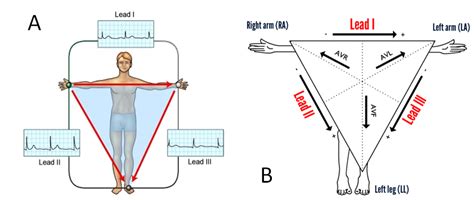 Maybe you would like to learn more about one of these? Elektrokardiyografi' ye Giriş | Resüsitasyon