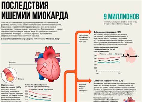 Диета при ишемии миокарда Последствия ишемии миокарда Последствия ишемии миокарда Диета при ишемии миокарда