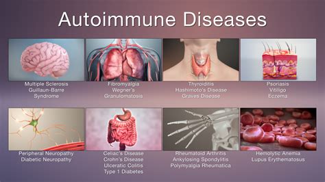 Autoimmune Diseases Symptoms And Treatments Scientific Animations