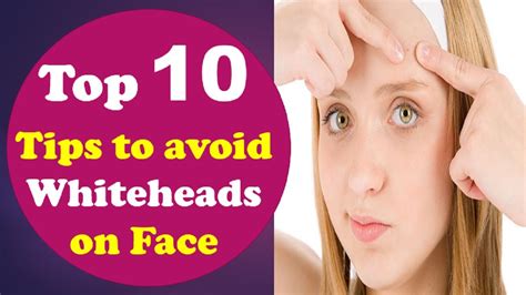 Top 10 Tips To Get Rid Of Whiteheads At Home 10 Tips On How To Deal