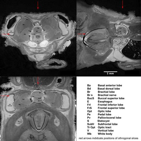 Anatomical Magnetic Resonance Imaging Simple Annotation O Bimaculoides