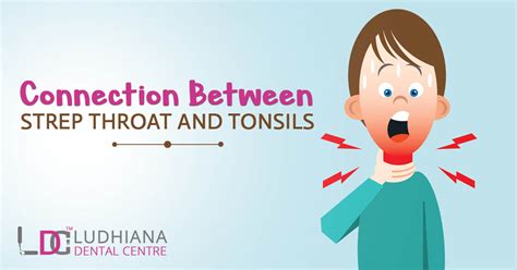 Connection Between Strep Throat And Tonsils
