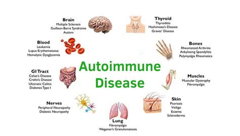 Ayurvedic Treatment For Autoimmune Disease