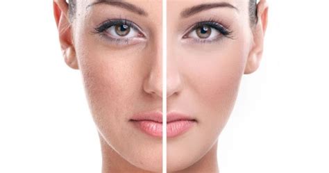 3 Things To Know About Facial Rejuvenation Therapies