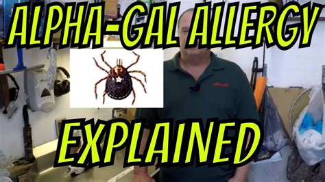 Alpha Gal Allergy Explained 2018 Youtube