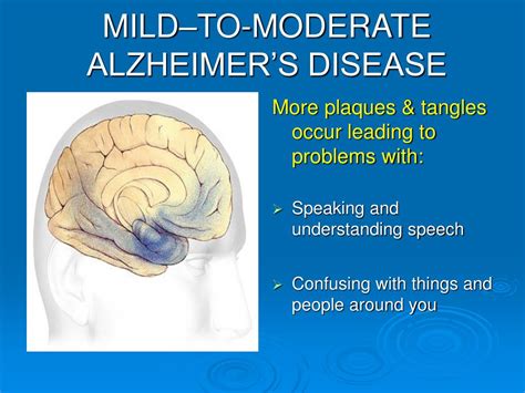 Ppt Alzheimers Disease Powerpoint Presentation Free Download Id