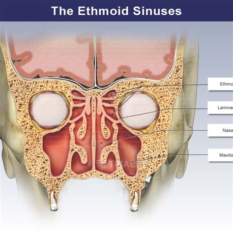 The Ethmoid Sinuses Trialexhibits Inc