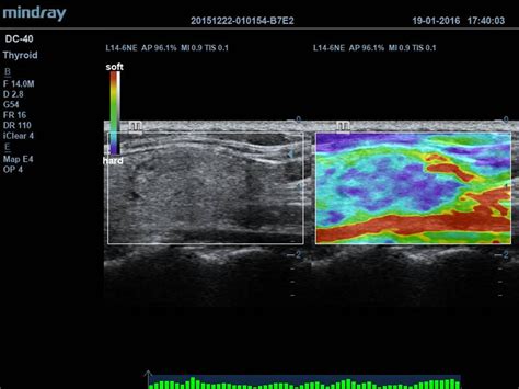 The dosimetric properties investigated in this work were dose rate, angular dependence and detector sensitivity and. M7 Premium | Ultrasound General Imaging Systems| Mindray India