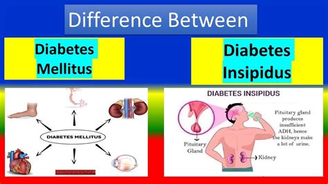 Difference Between Diabetes Mellitus And Diabetes Insipidus Youtube