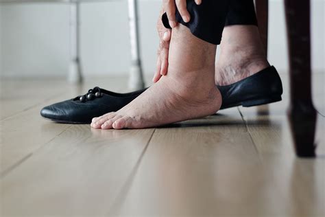 What Causes Swollen Feet In Elderly People