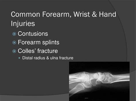 Ppt Forearm Wrist And Hand Evaluation Powerpoint Presentation D87