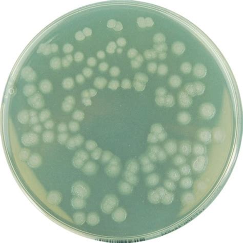 Agar Petri Plates Prepared Nutrient