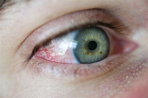 Free Stock Image Of Close Up Detail Of The Human Eye