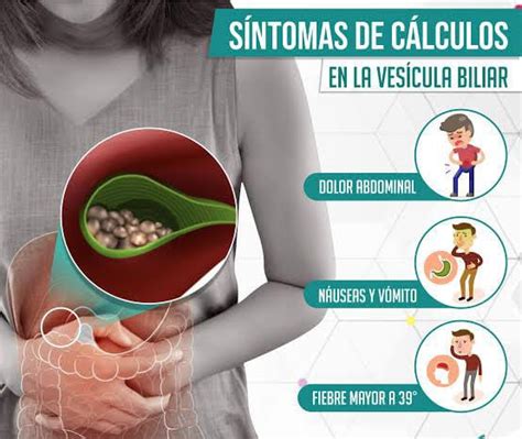 Cálculos en la vesícula síntomas y tratamiento La Razón