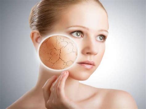 4 основные причины почему шелушится кожа на лице