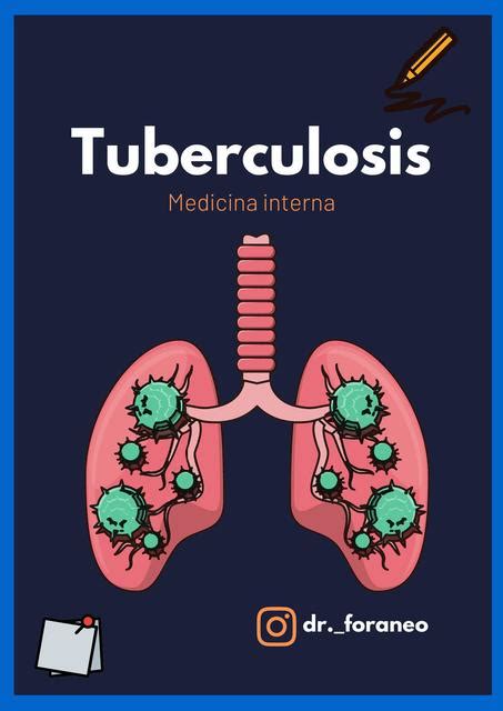 Tuberculosis Pulmonar Bryan Gamonal Siapo Udocz