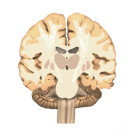 Coronal Section Of The Brain Photograph By Medical Images Universal
