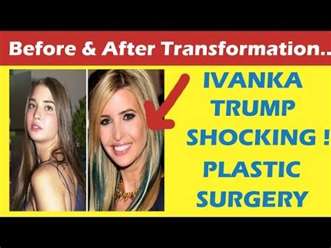 We will talk about ivanka trump before and after plastic surgery and try to figure out why a pretty young and successful woman has already done quite a lot . Ivanka Trump Plastic Surgery Before and After Full HD ...