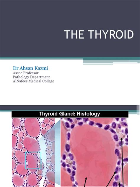 Pathology Of Thyroid Gland Pdf Thyroid Hypothyroidism