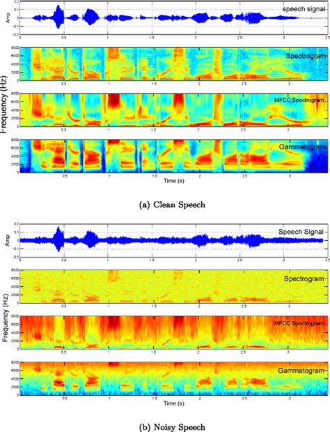 Speech Signal Spectrogram Mfcc Spectrogram And Gammatongram Of Female