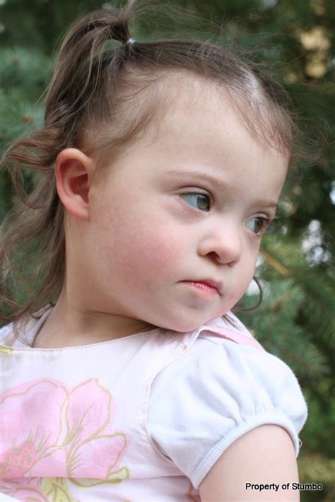 Hypotonia refrains the baby from having a tight fist when he/she is in the womb. Special Needs Baby: Physical Characteristics of Down Syndrome: Taking a Closer Look