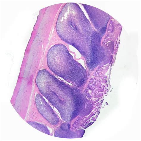 Lymphatic System Histology And Histophathology