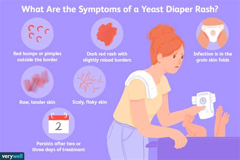 What Is A Diaper Rash Vlrengbr