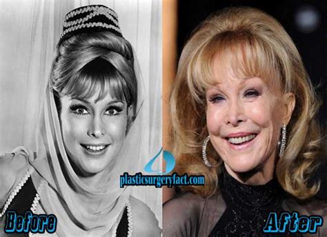 Barbara Eden Plastic Surgery Before And After Photos