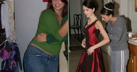 Photos Of Anorexic Woman Used As Example Of Amazing Weight Loss