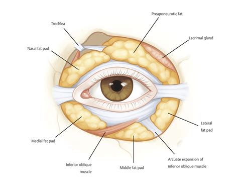 10 Transconjunctival Lower Eyelid Blepharoplasty Ento Key
