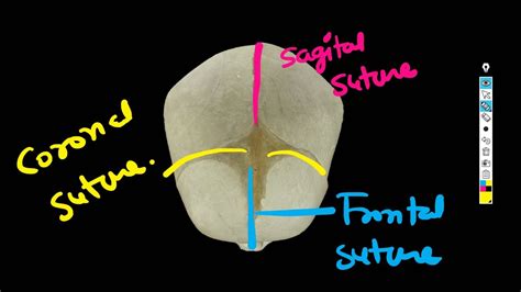 Fetal Skull Sutures And Fontanelles Short Lacture Youtube