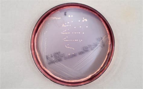 Enriched Tryptic Soy Agar Etsa Anaerobe Systems