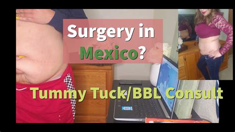 I went to culiacan sinaloa to get lipo 360 with bbl!! #tummytuck #bbl Tummy Tuck/BBL MEXICO Consultation Advice ...