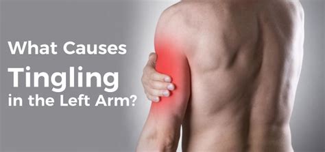 What Causes Tingling In The Left Arm How To Treat It