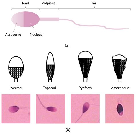 human sperm under microscope