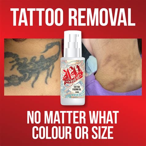 Wrecking balm has mixed reviews. tattoo removal cream smp - Redeem Clinic