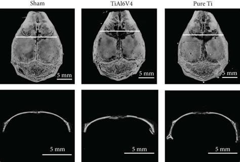 Microcomputed Tomography With 3 Dimensional Reconstruction Of Calvarial Download Scientific