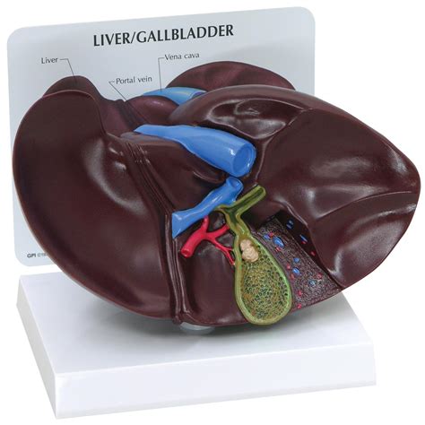 Livergallbladder Model With Gallstones 1019551 3300 Anatomical