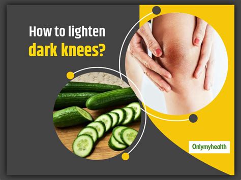 Here Are 7 Home Remedies To Lighten Dark Knees Onlymyhealth