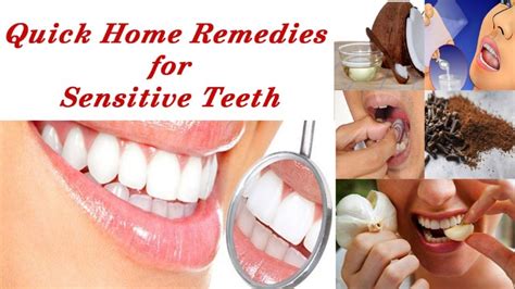 Quick Home Remedies For Sensitive Teeth Youtube